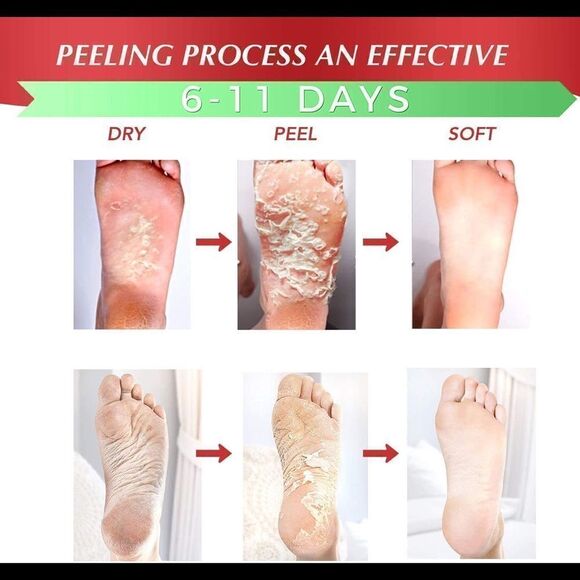 🌟EXFOLIATING Foot Peel Mask For Softer, Smooth Feet- Gently Skin (2 Pack)🌟 - Picture 4 of 6